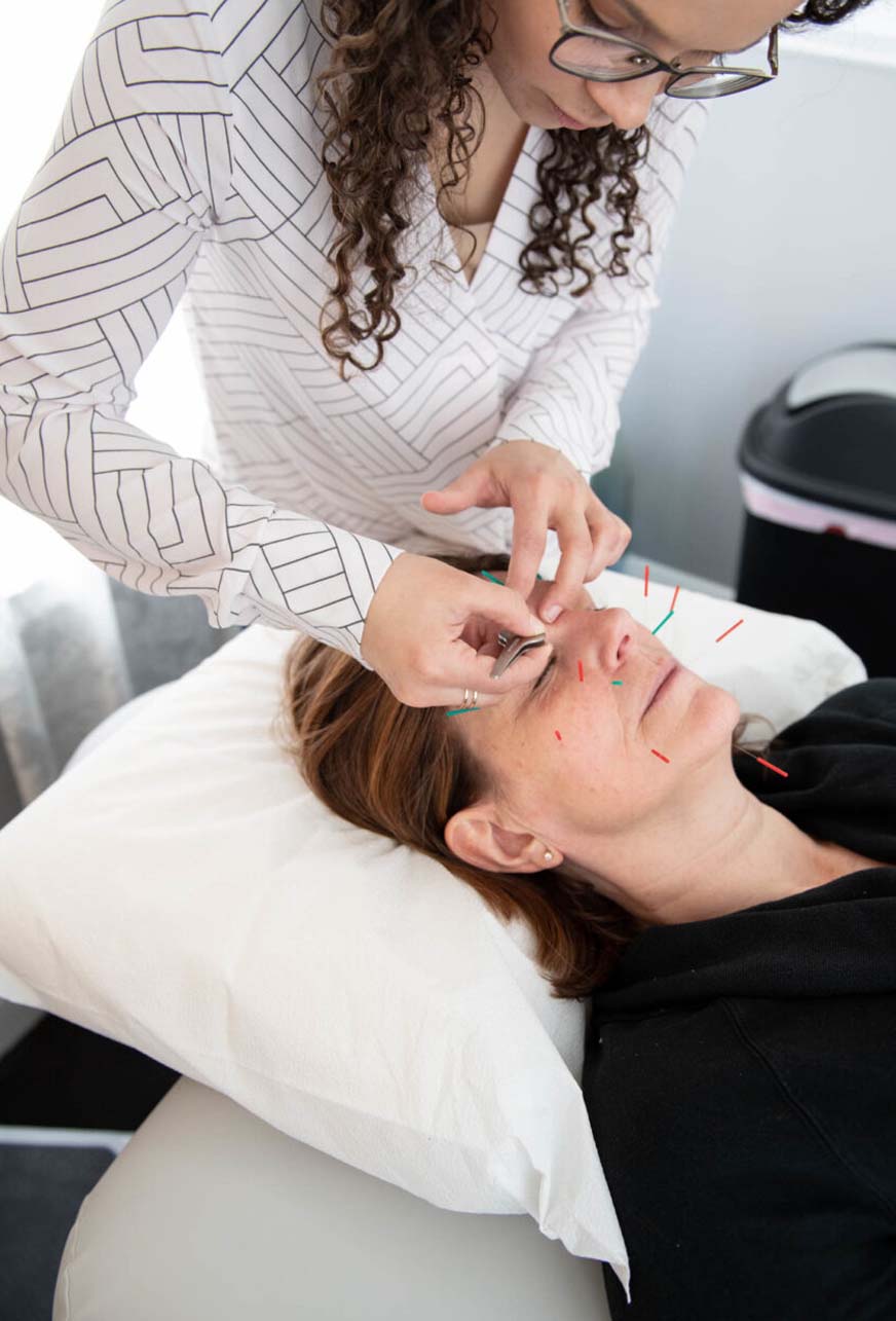 Dr. Placeres performs a facial acupuncture treatment on a woman resting comfortably on a pillow